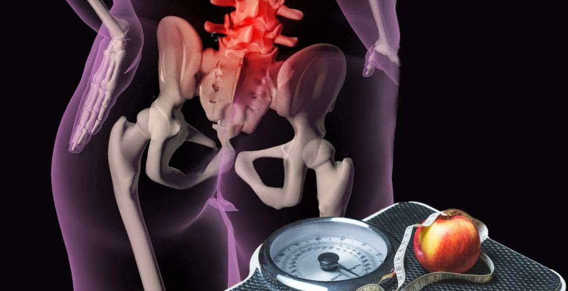 blog illustration of overweight person with back pain and scale with apple on top