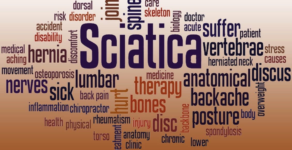 stock photo sciatica word cloud concept on white background