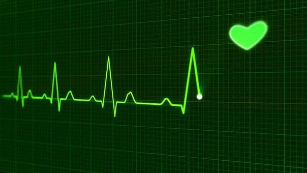 ekg machine image showing good heart beat rate