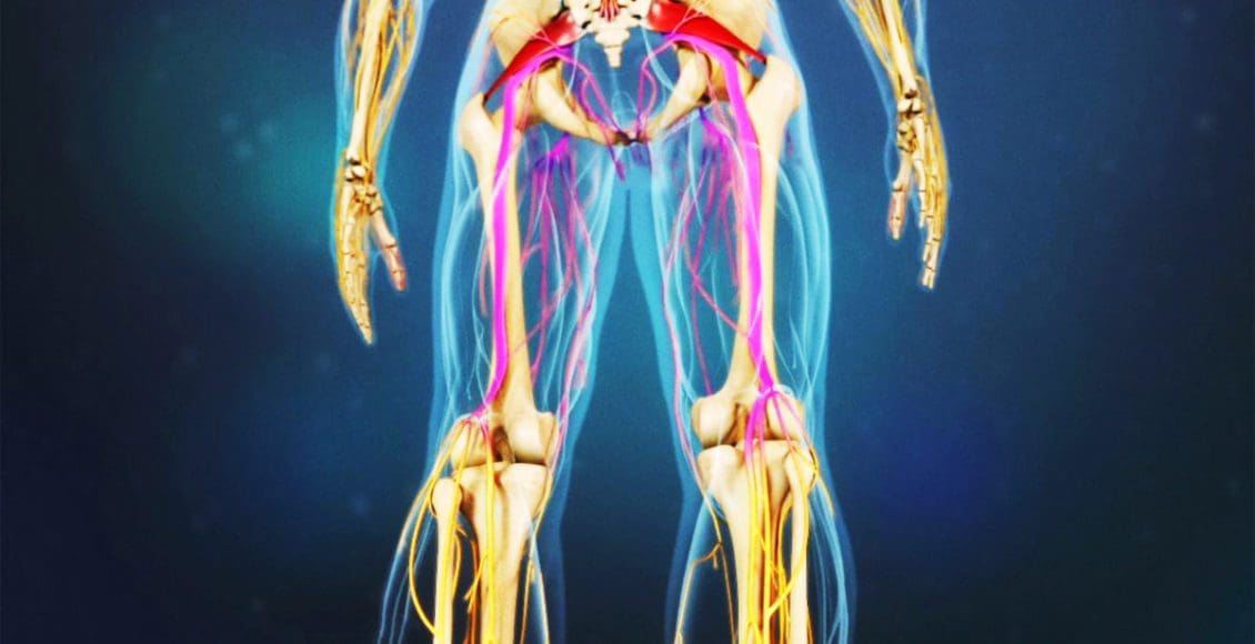 piriformis syndrome leg pain