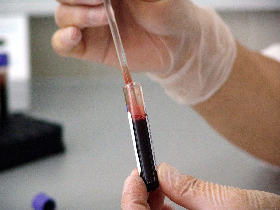 Exploring the Role of Blood Tests in Identifying Back Pain Causes