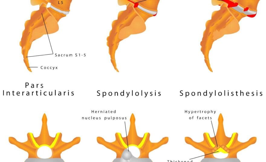 Postural Orthostatic Tachycardia Syndrome (POTS) in El Paso, TX