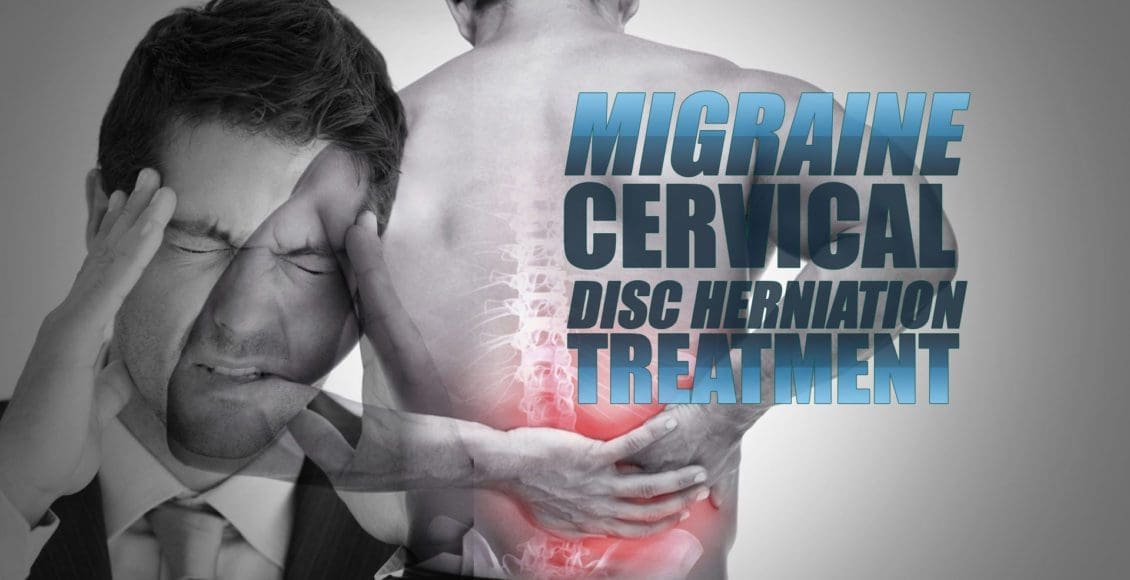 Migraine and Cervical Disc Herniation Treatment In El Paso, TX Chiropractor