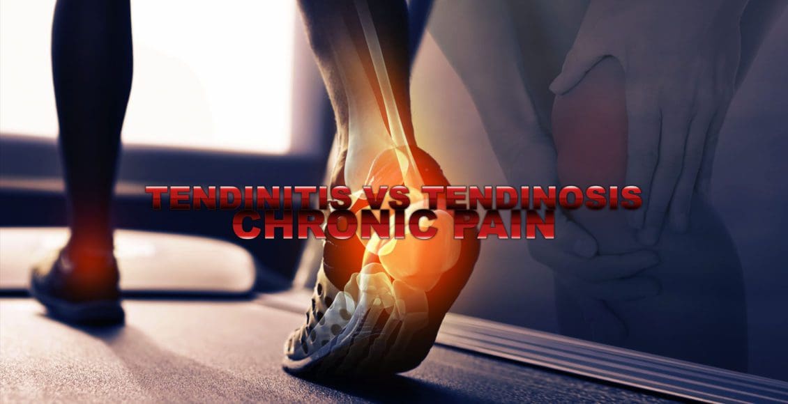 tendinosis