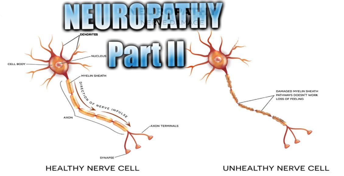 neuropathy presentation el paso tx.