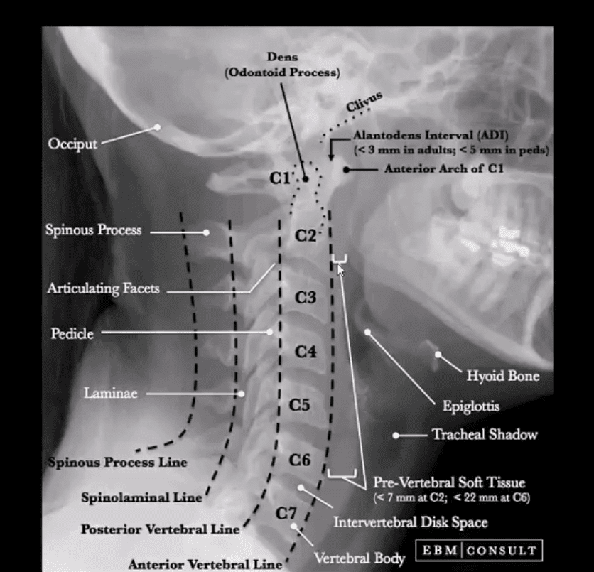 spinal trauma el paso tx.