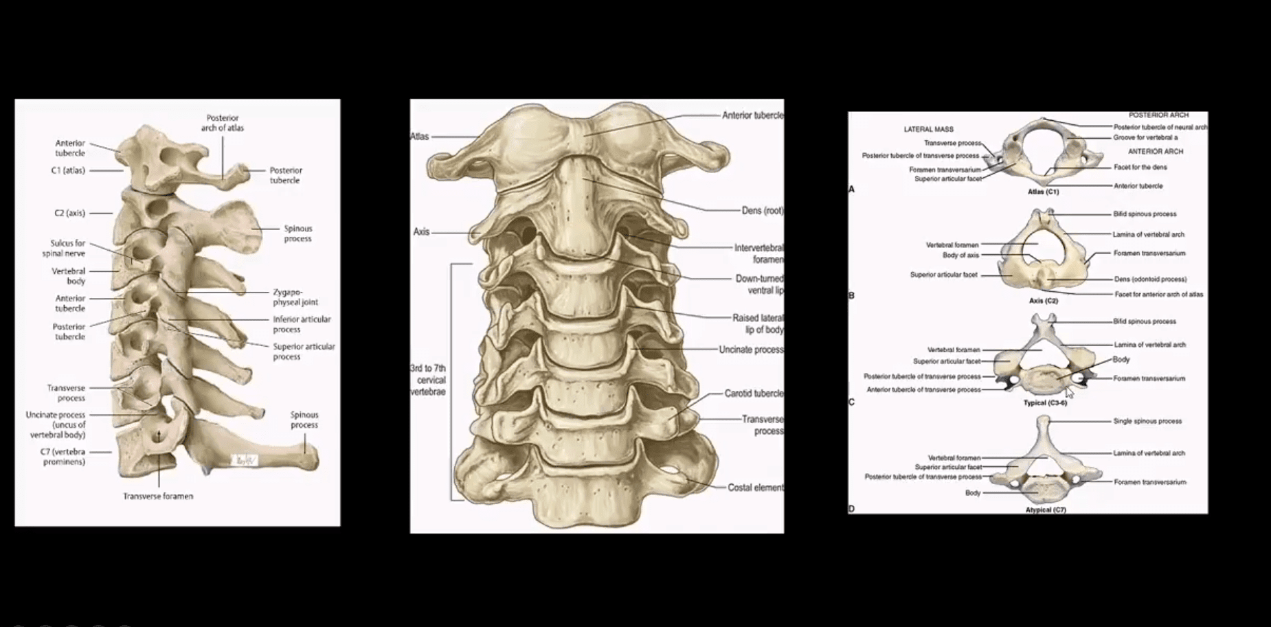 spinal trauma el paso tx.