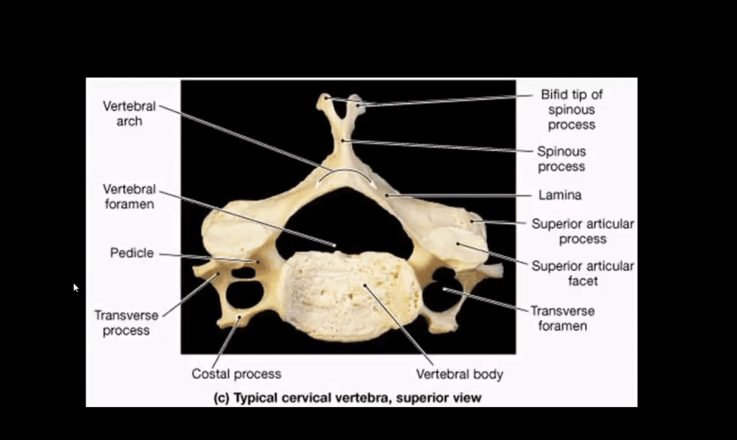 spinal trauma el paso tx.