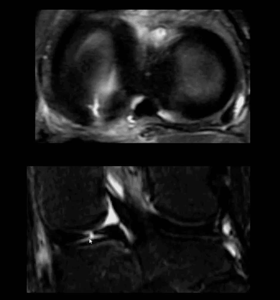 knee pain acute trauma el paso tx.