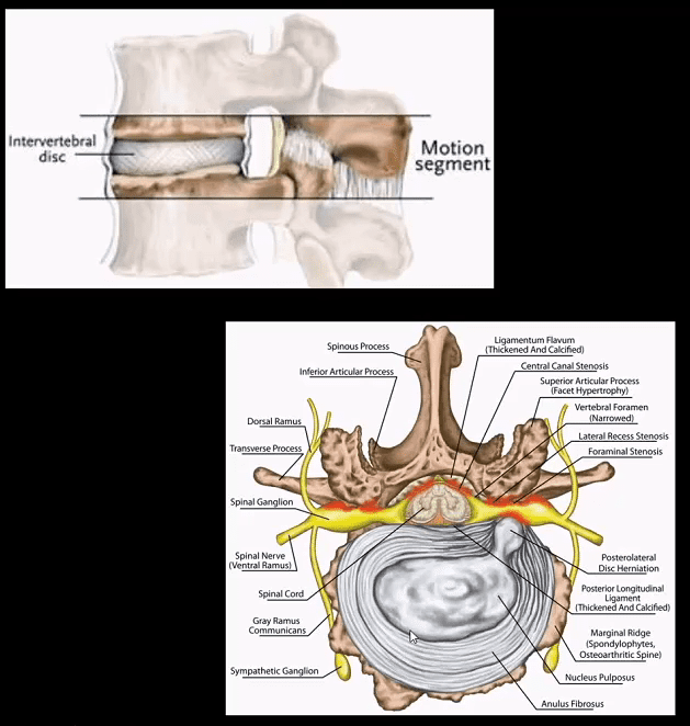 spinal arthritis el paso tx.