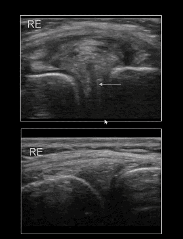 knee pain acute trauma el paso tx.