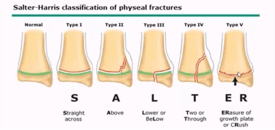 ankle foot arthritis and trauma el paso tx.