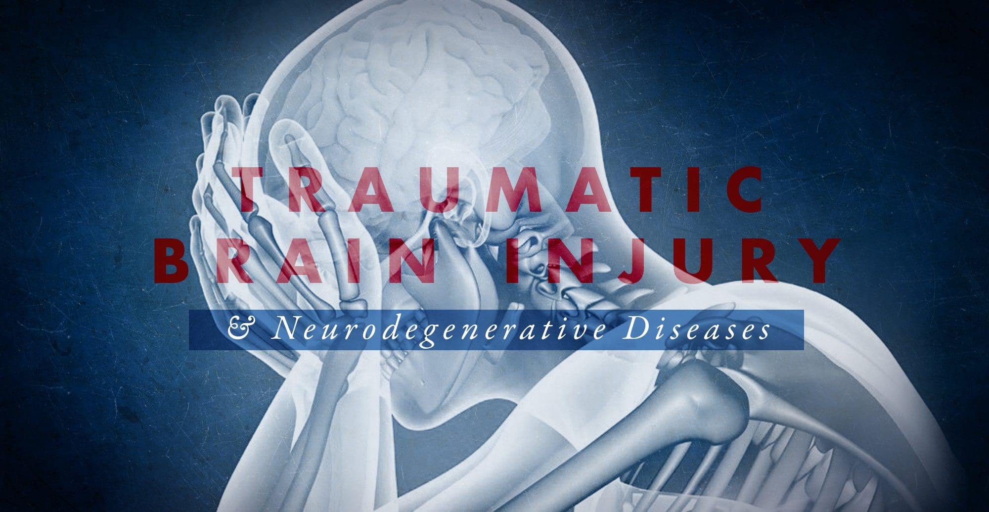 Functional Neurology: TBI and Neurodegenerative Diseases | El Paso, TX Chiropractor