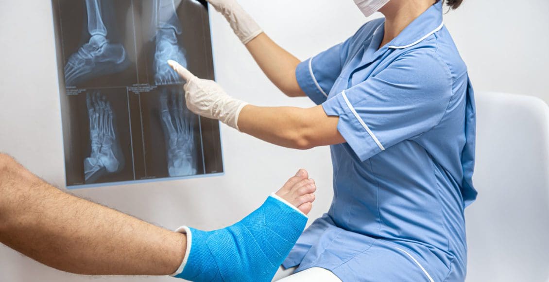 Ankle Fracture Chiropractor - El Paso, TX Doctor Of Chiropractic