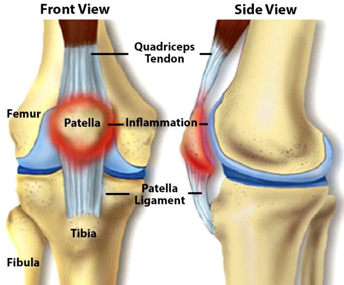 Knee Injuries, Surgeries, and Vitamin D Status