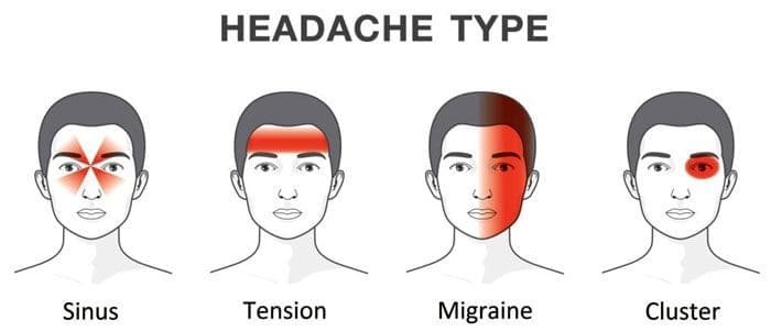 Headache Trigger Points and Bio-Chiropractic Treatment