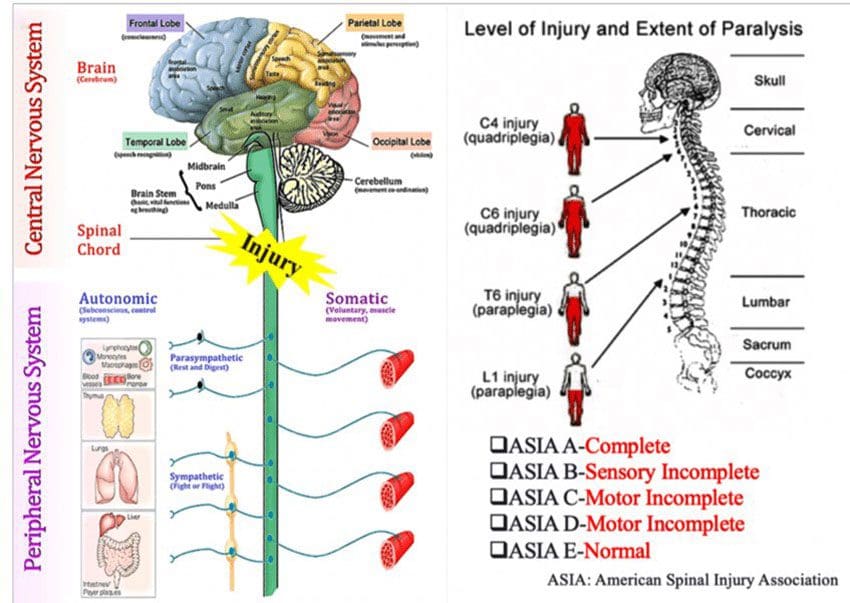 Non-Traumatic Spinal Cord Injury