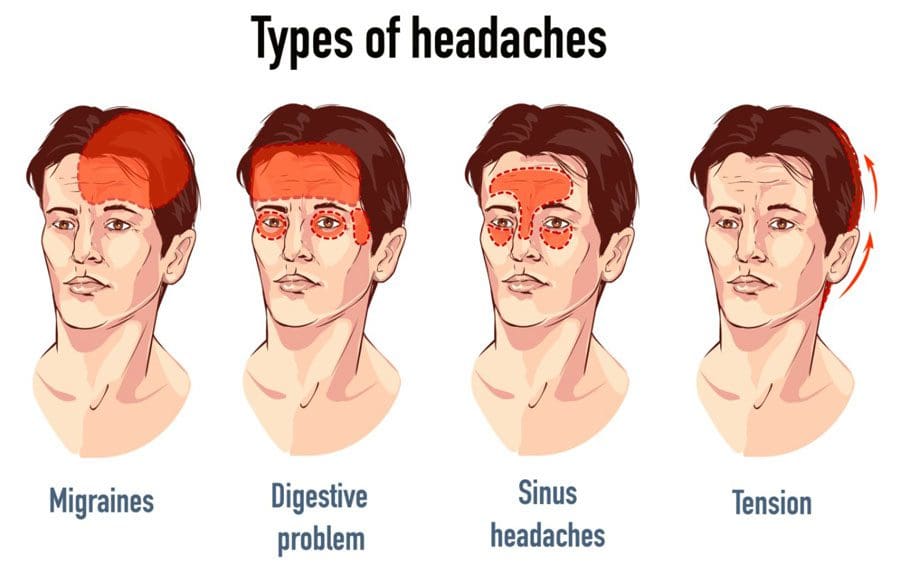 Most Common Form Of Pain The Headache