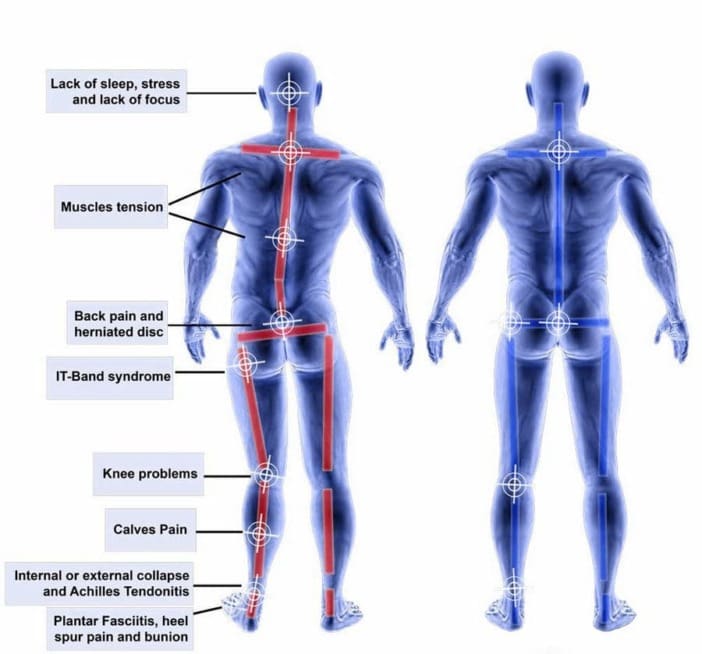 Antalgic Dealing with Antalgic Gait: Causes and Treatment Options - El Paso, TX ...