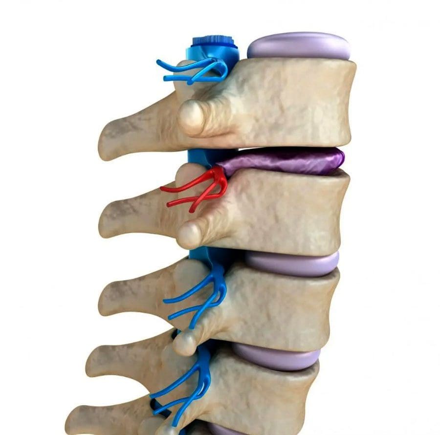 Dehydrated Spinal Discs: Rehydration and Decompression