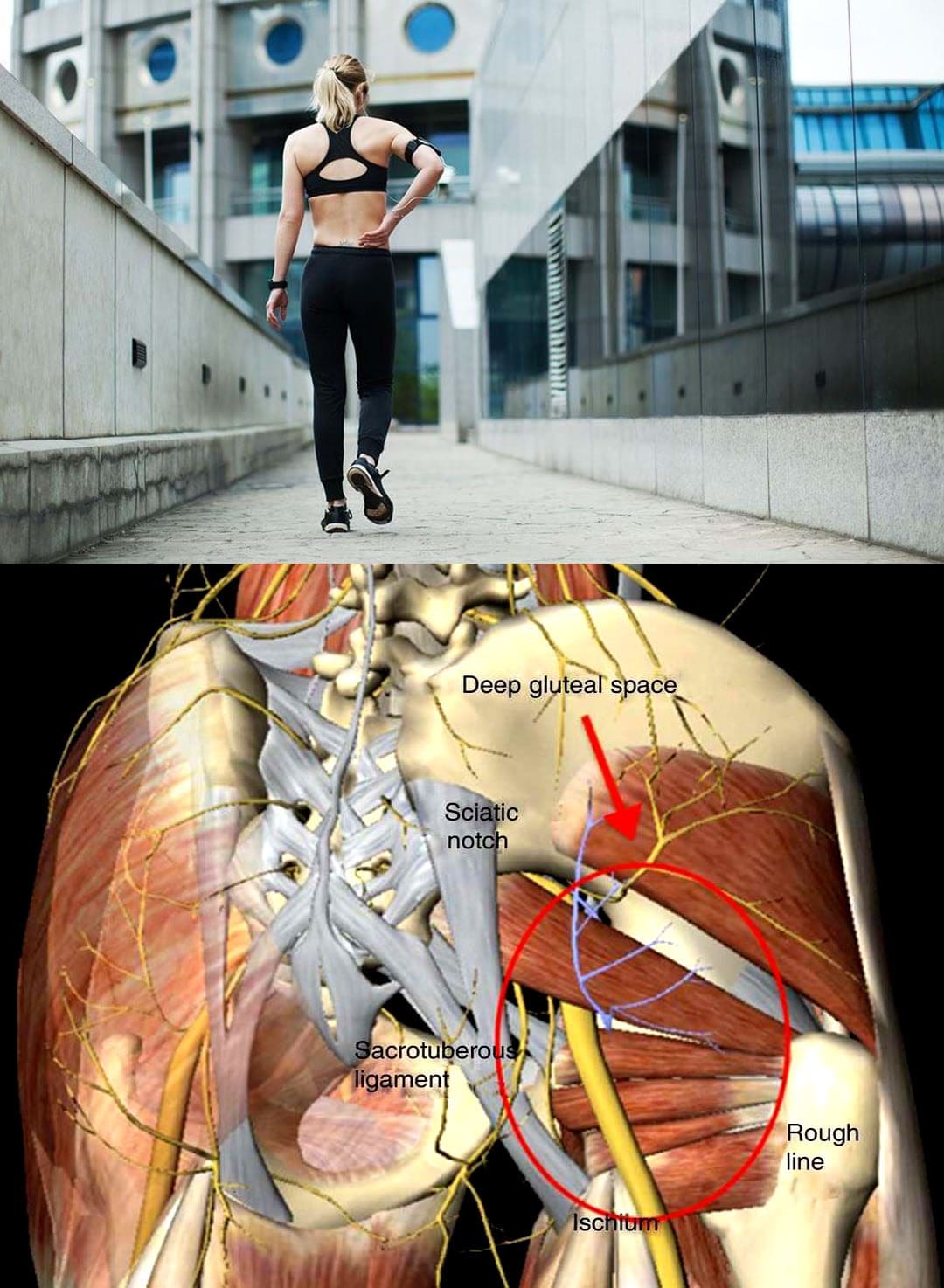 Sciatica From Working Out: EP's Chiropractic Team