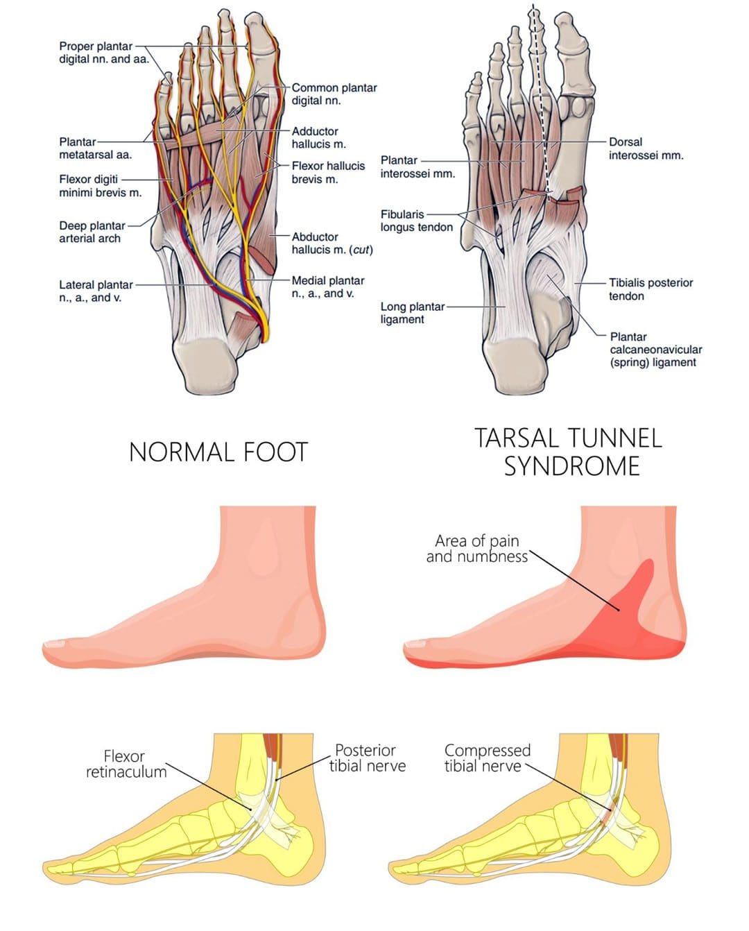 Running Foot Numbness: EP Chiropractic Injury Team
