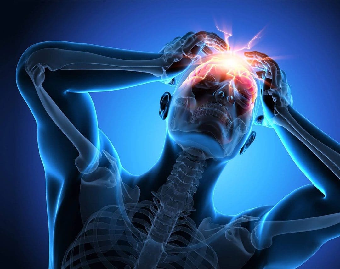 Headaches on Top of the Head? What's Behind the Pain