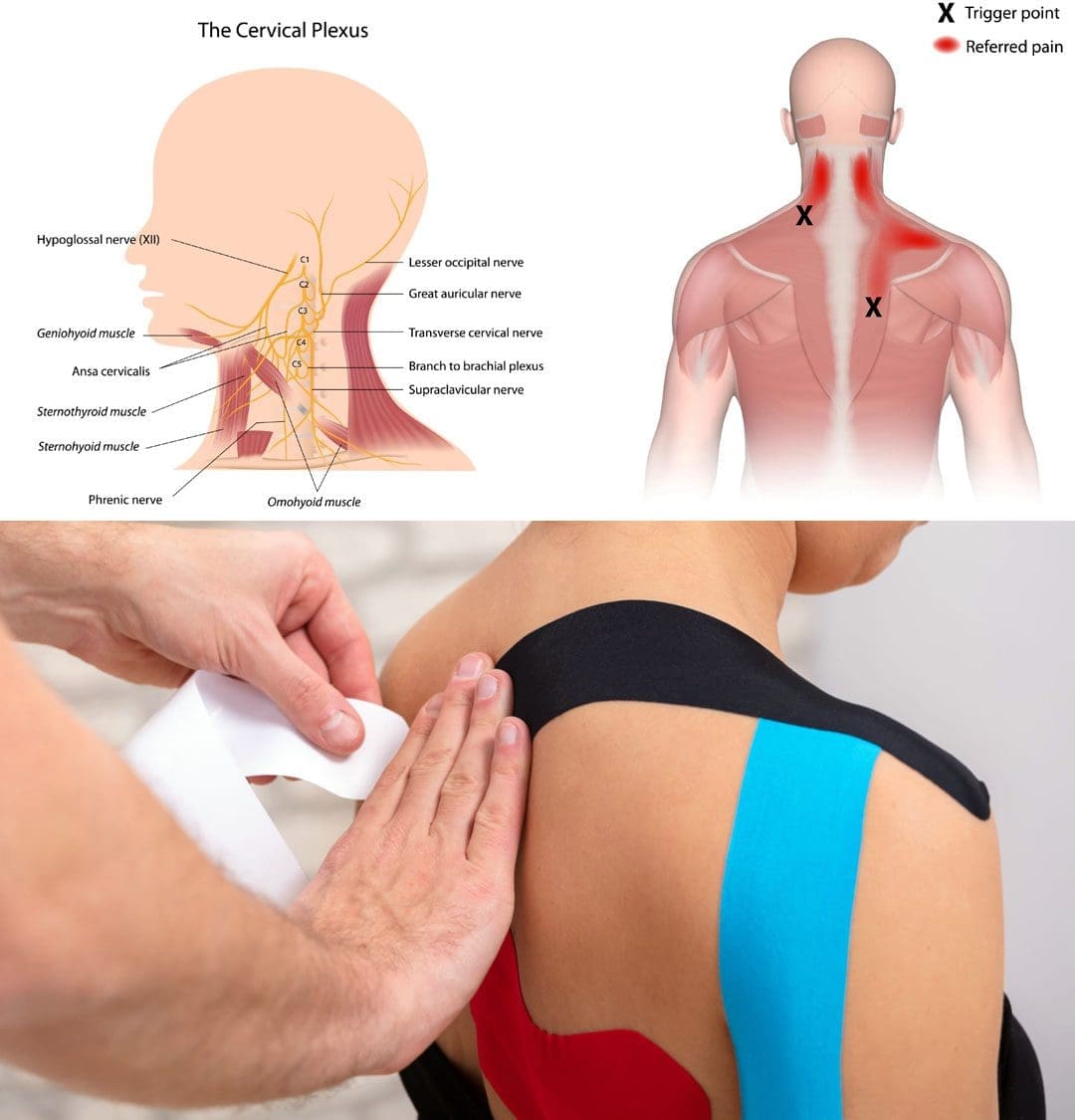 Kinesiology Tape For Neck And Shoulder Pain Relief A Guide El Paso Kinesiology Tape For Neck And Shoulder Pain Relief A Guide El Paso