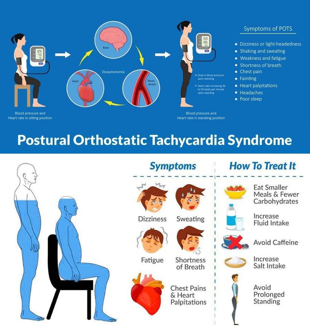 Postural Orthostatic Tachycardia Syndrome: Causes & Treatment