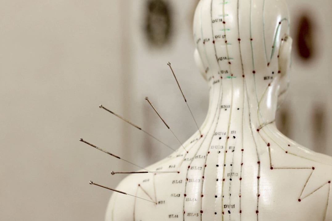 Akupunktura za nespečnost: celostni pristop k boljšemu spancu