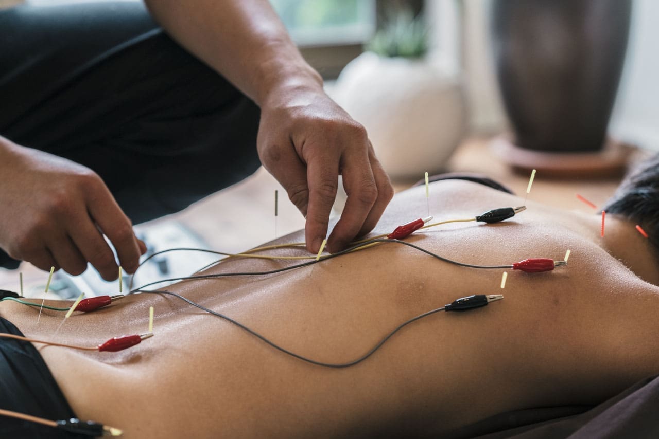 La guida definitiva alla terapia con elettroagopuntura per alleviare il dolore