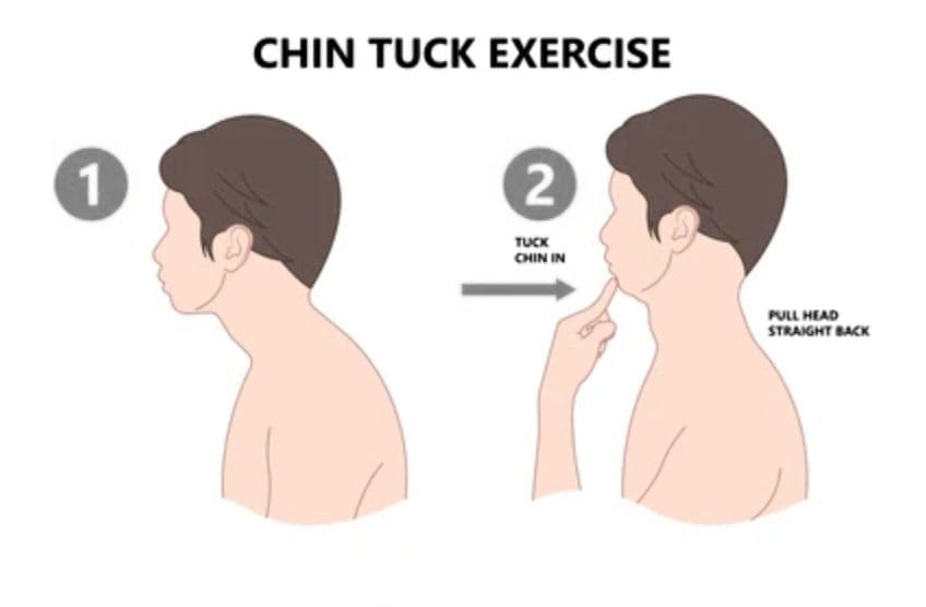 Cervical Retraction: An Effective Exercise for Neck Pain Relief