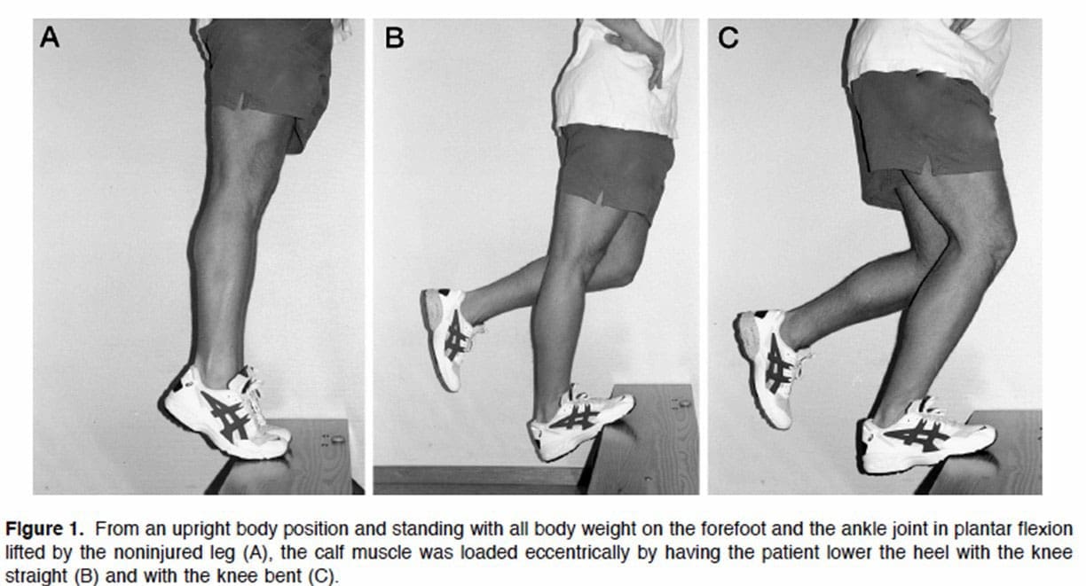 How to Implement an Exercise Protocol for Achilles Tendonitis