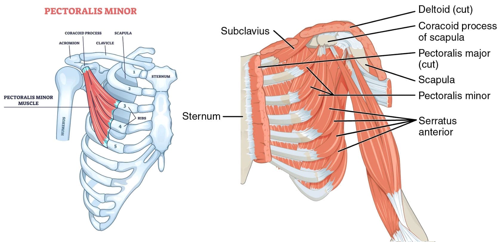 Pectoralis Minor Tightness and Its Effects on Health