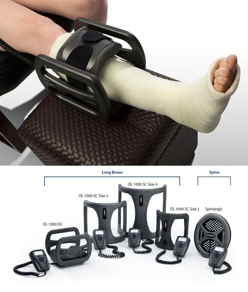Bone Growth Stimulator: Accelerate Healing Process