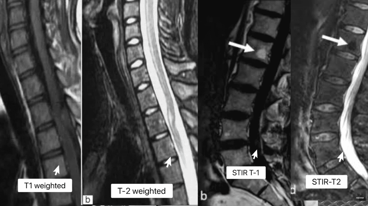 T1 Weighted, T2 Weighted, STIR T1, STIR T2