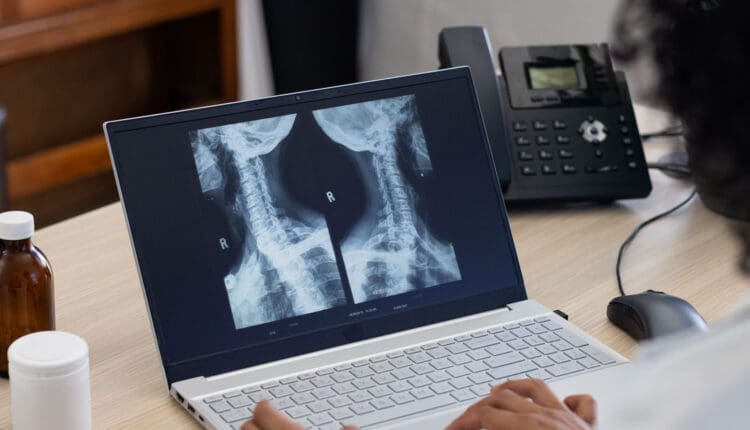 ESWT para lesiones por accidentes de tráfico: beneficios y usos