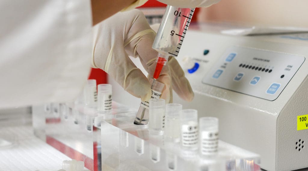 Ondas de choque ECSWT, PRP, PFP