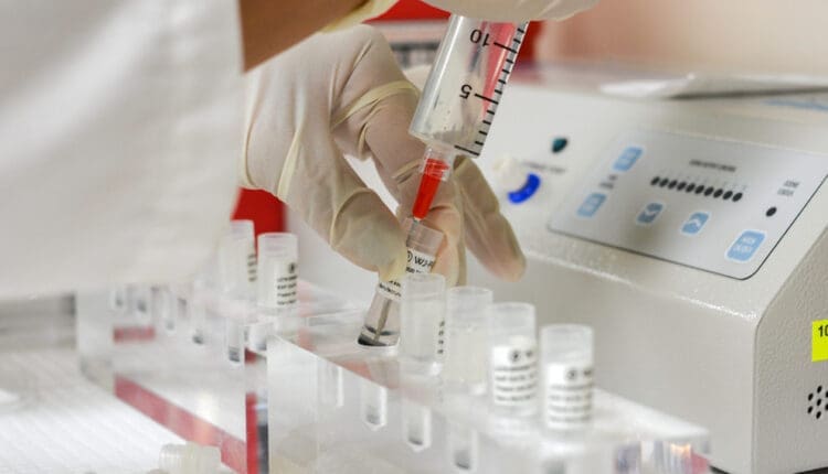 Terapia de ondas suaves PRP ECSWT