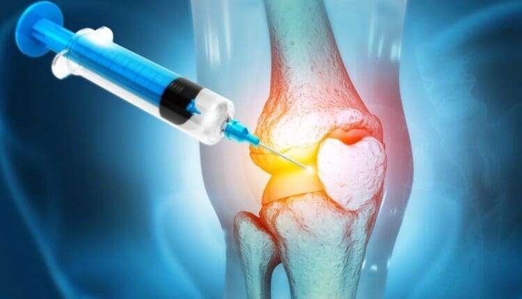 Platelet-Rich Plasma Dosing for Injury Recovery Guidelines