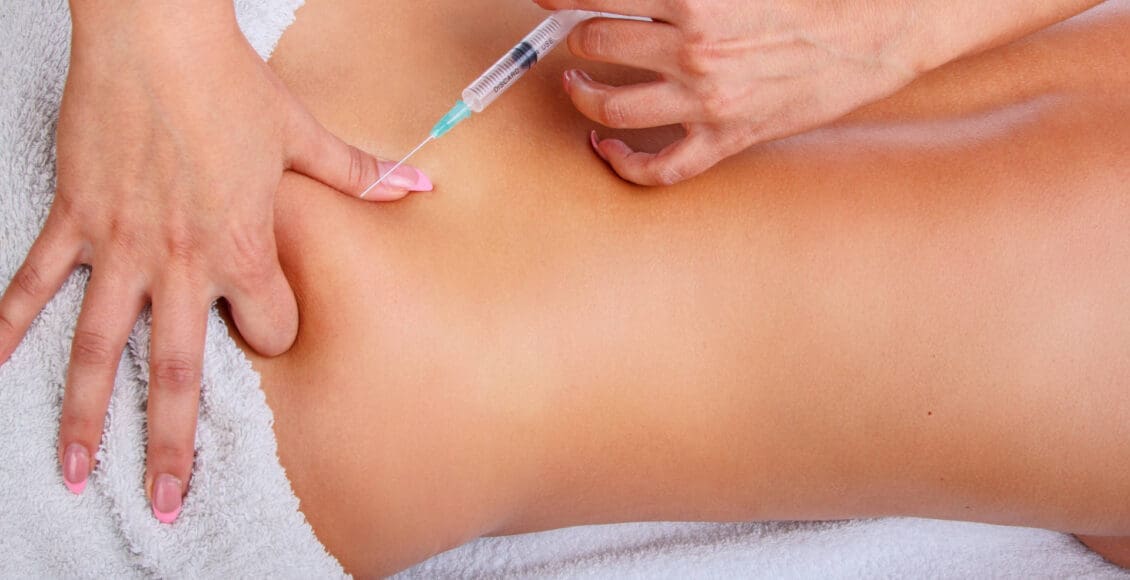 Terapia con plasma rico en plaquetas para la ciática: El futuro del tratamiento del dolor.