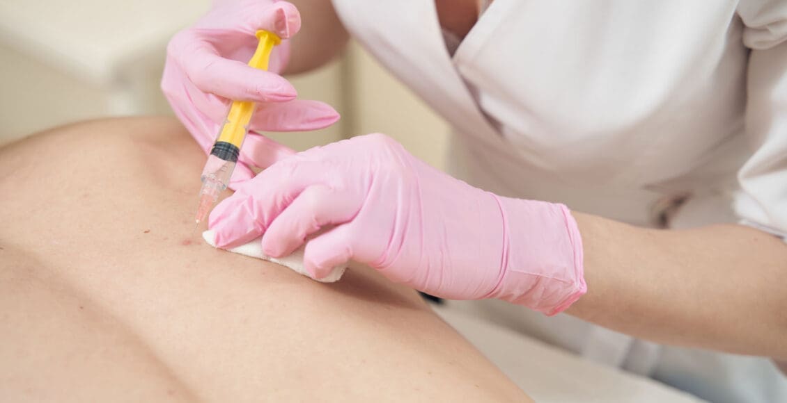 Terapia con plasma rico en plaquetas (PRP) para el cuidado de la columna vertebral: una solución moderna.