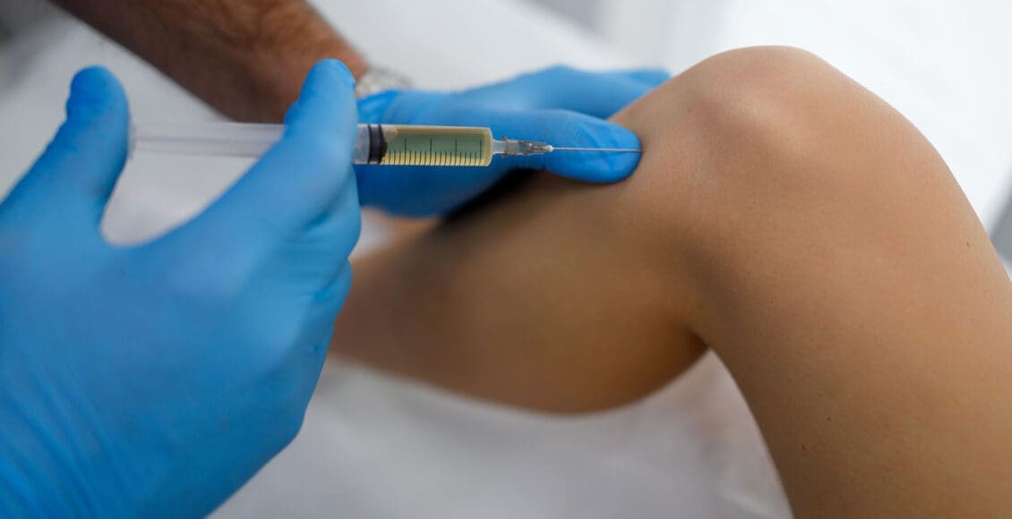 Tratamiento con plasma rico en plaquetas (PRP) para desgarros de menisco de rodilla y su curación.