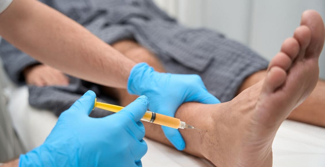 Terapia con plasma rico en plaquetas para la neuropatía: una solución curativa