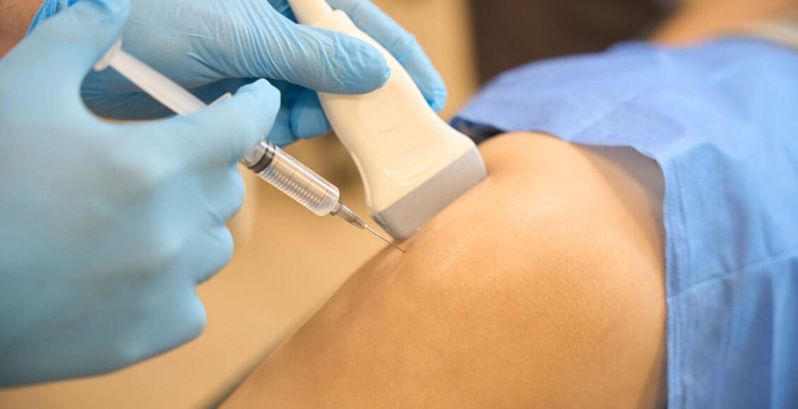 Terapia con plasma rico en plaquetas (PRP) para lesiones deportivas: reduce el tiempo de recuperación.