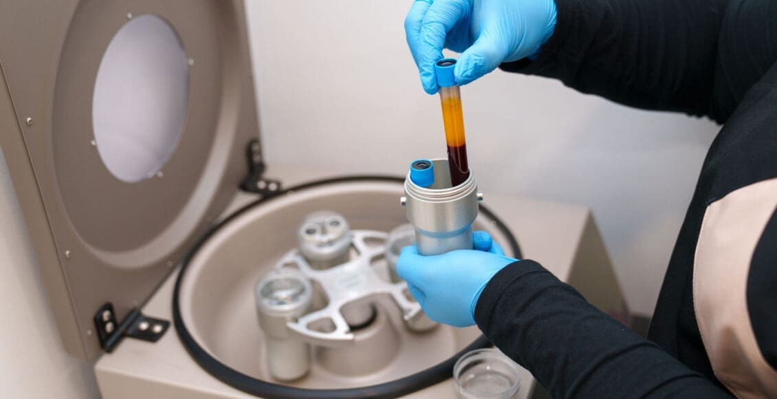 PRP and Chiropractic for Faster Injury Recovery Explained